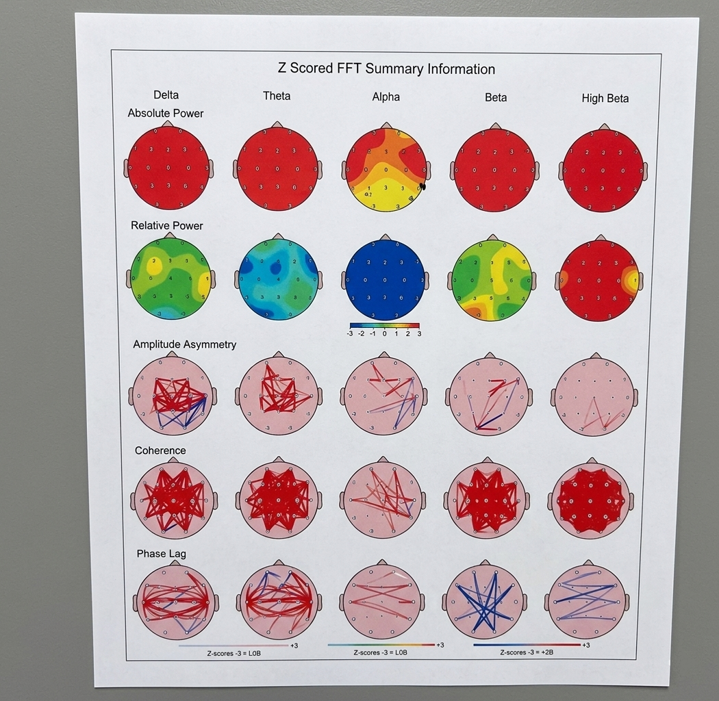 Meditative State A — topographic head map