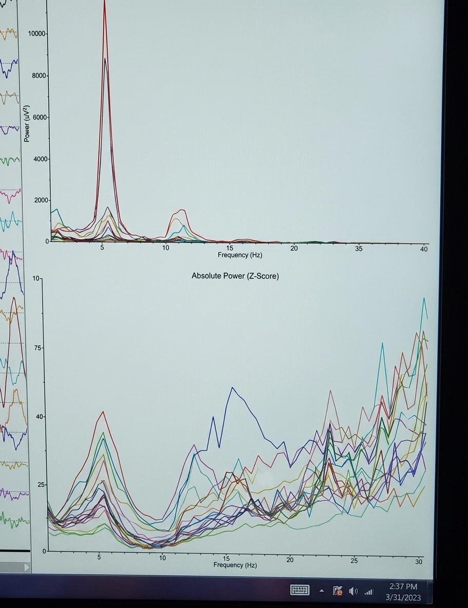 Meditative State B — z-score and frequency graph